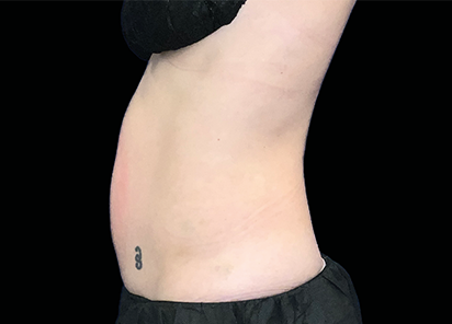Core to Floor 002 After Female Abdomen JD Mccoy MD