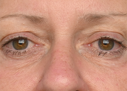 Emface PIC Ba card female eyes 160 ENUS100 after