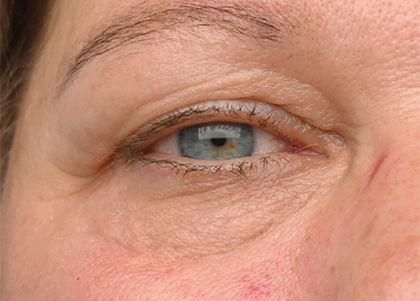Emface PIC Ba card female eyes 162 ENUS100 after