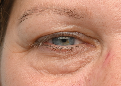 Emface PIC Ba card female eyes 162 ENUS100 before