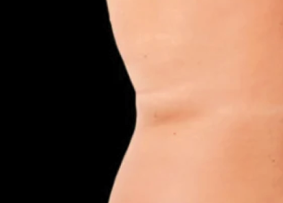 Exion Desktop BA Cards Body AFTER BODY