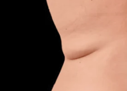 Exion Desktop BA Cards Body BEFORE BODY