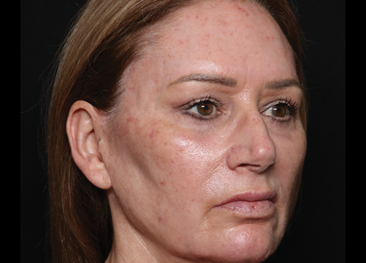 Exion Desktop BA Cards ClearRF BEFORE CLEAR RF