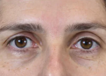 Exion Desktop BA Cards Face AFTER FACE 3