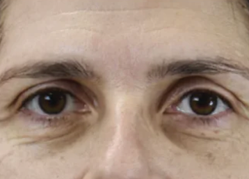 Exion Desktop BA Cards Face BEFORE FACE 3