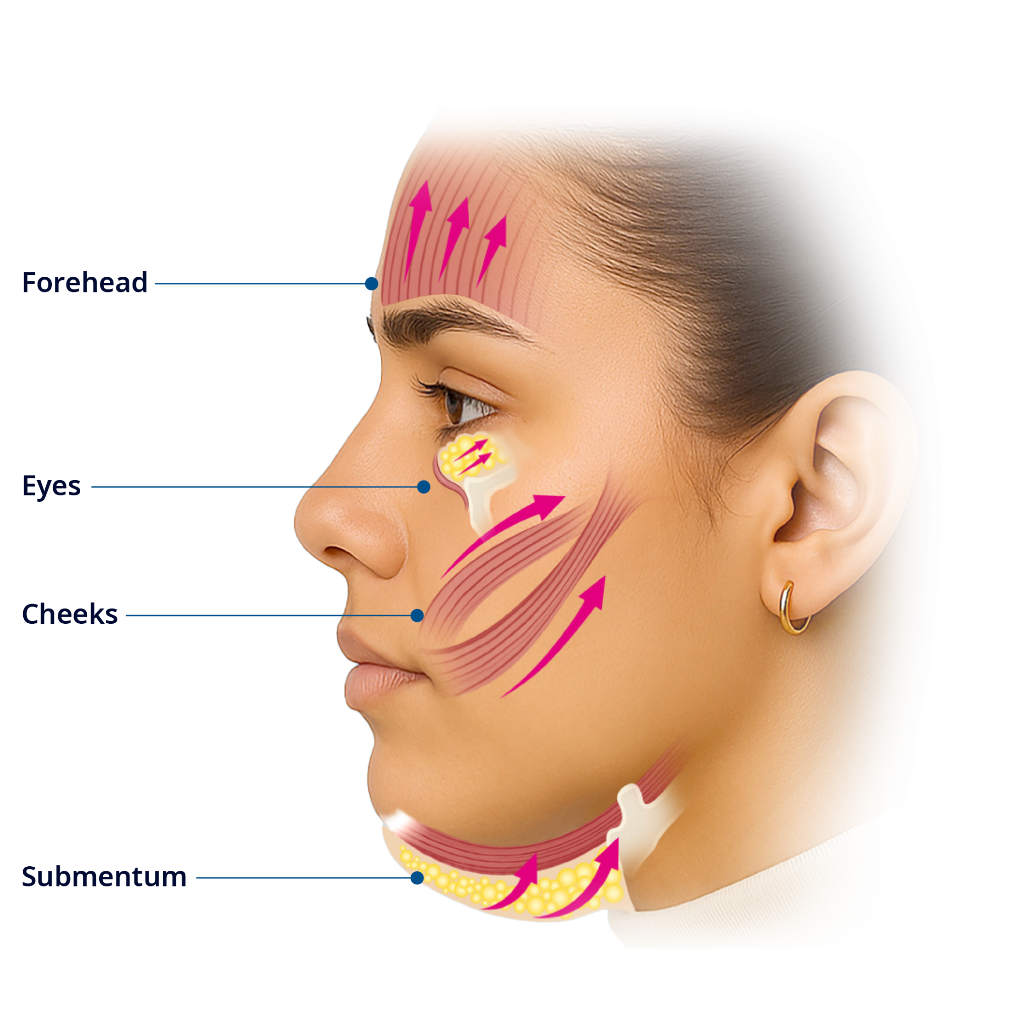 Encise Face Emface - Face
