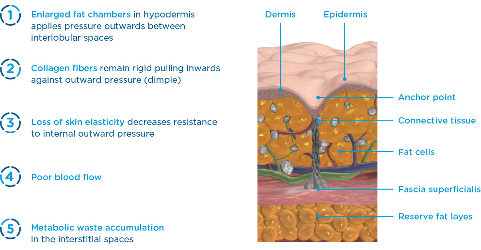 Emtone how does it work image 1 Emtone how does it work image 1